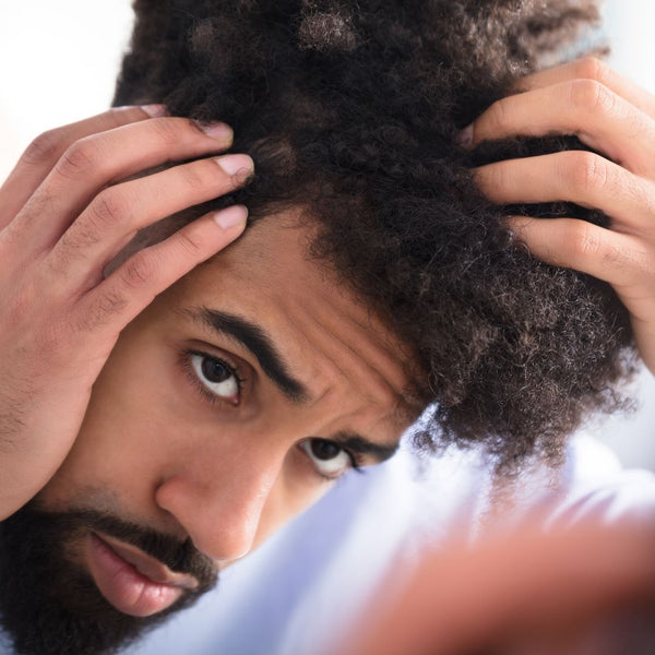 Dry scalp or Dandruff?